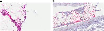 Identification of a New Infectious Pancreatic Necrosis Virus (IPNV) Variant in Atlantic Salmon (Salmo salar L.) that can Cause High Mortality Even in Genetically Resistant Fish